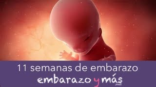 11 semanas de embarazo  Tercer mes  EMBARAZOYMAS [upl. by Koblas160]