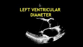 How to measure the LEFT VENTRICULAR DIAMETER Echocardiography [upl. by Onitsuj]