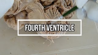 Fourth ventricle  neuroanatomy  floor  opening [upl. by Osbourne500]