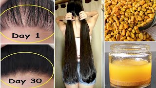 15 Days Challenge  Extreme Hair Growth  Worlds Best Faster Remedy for Hair Growth [upl. by Leyla942]