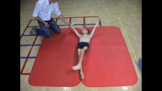 Dyskinetic cerebral palsy case 3 [upl. by Yerrot280]