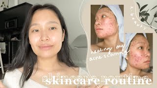 my holy grail skincare routine  how I healed my severe acne scarring texture amp hyperpigmentation [upl. by Glori522]